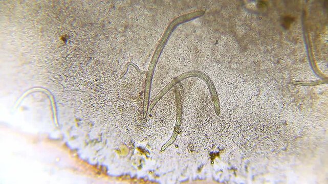 Nematodes and bacteria in alcohol during mixing with water under 100x magnification bright field microscopy. 4K scientific microscopy footage.