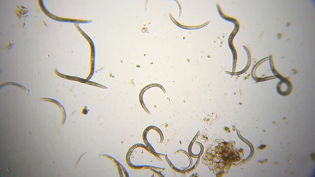 Low mobility nematodes in water drop panoramic view under 40x magnification bright field microscopy. 4K scientific microscopy footage.