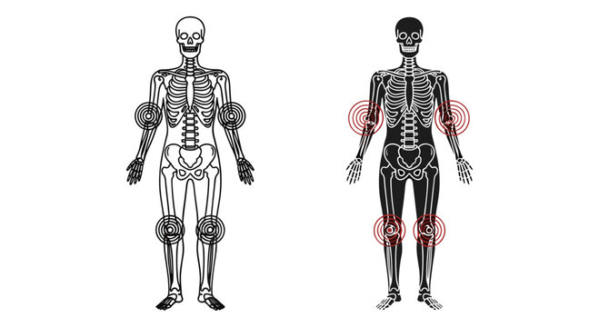 Human skeleton anatomy vector with joint pain highlights, medical illustration of bone structure and inflammation, body ache diagram for healthcare