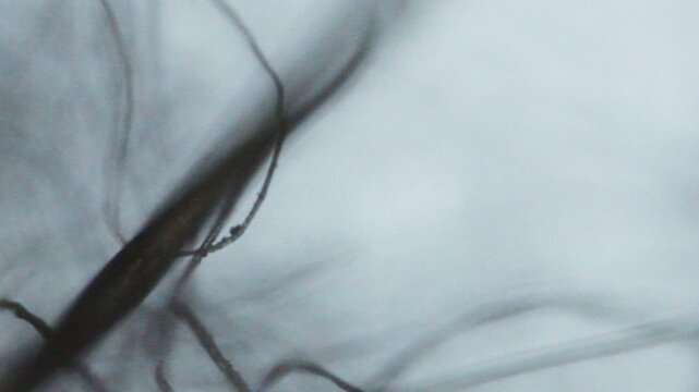 Focusing lints moving seen through an optical microscope