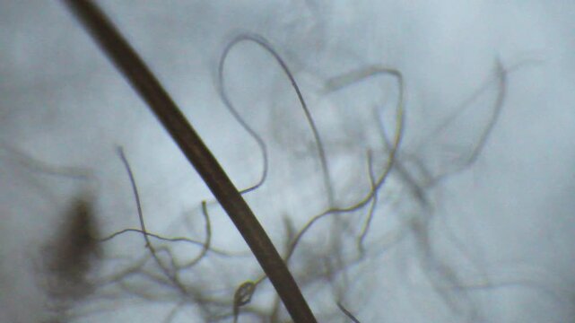 Threads lint seen with an optical microscope