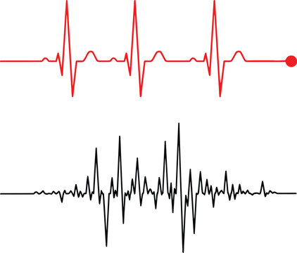 A comparison between a normal regular heartbeat rhythm and an irregular erratic signal waveform Vector