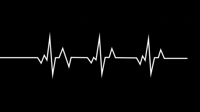 Heartbeat Ecg Monitor Pulse Line Loop Animation White On Black Background