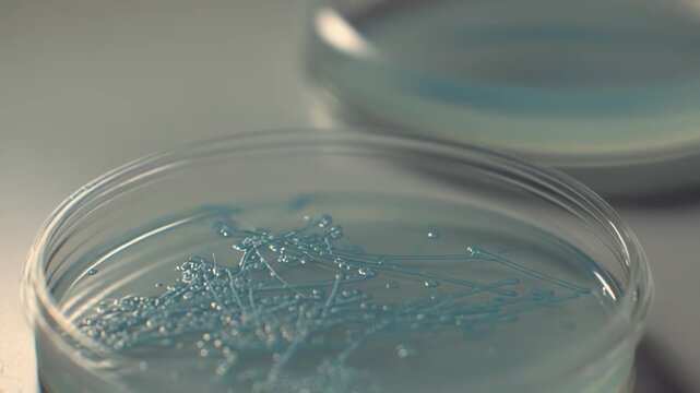 Petri dish holding a bacterial culture growing on an agar medium, developing for microbiology research and biotechnology studies in a laboratory setting