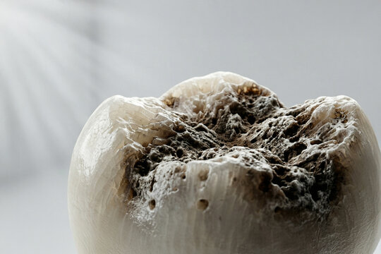 AI generated, AI content, dental tooth implant, cavity oral health