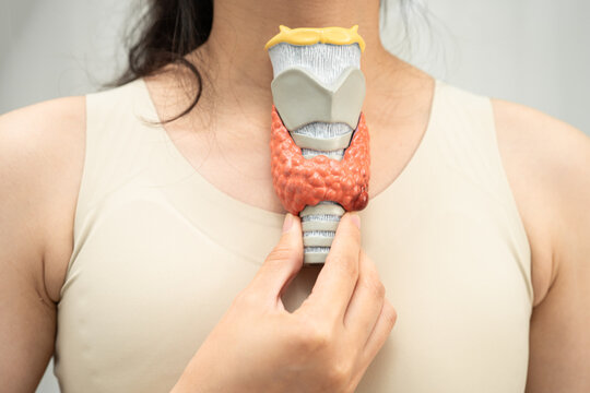 Hyperthyroidism, Overactive Thyroid, Thyroid Lymphoma, Asian woman with thyroid gland human anatomy model.