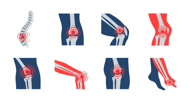 Human Body Joint Pain and Inflammation Icons Set