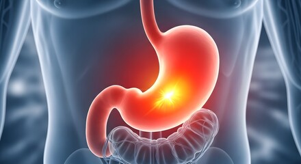 Glowing stomach ulcer and acid reflux in the digestive system. Gastroenterology and gastric health. 3D anatomical view of a stomach with a bright spot indicating inflammation or pain