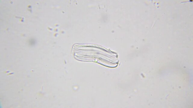 Diatom with surrounding bacteria under 1000x magnification brightfield microscopy with immersion oil. 4K scientific microscopy footage.