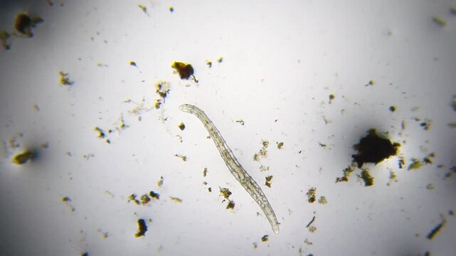 Oligochaete worm moving among detritus with visible digestive tract under 40x magnification brightfield microscopy. 4K scientific microscopy footage.