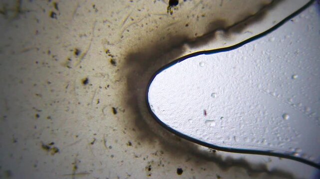 Bacterial aggregation with nematodes and protozoa under 40x magnification brightfield microscopy. 4K scientific microscopy footage.