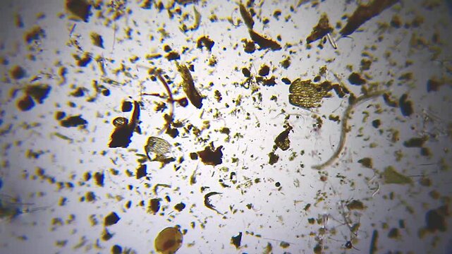 Multiple nematodes moving in wave-like motion among detritus under 40x magnification brightfield microscopy. 4K scientific microscopy footage.