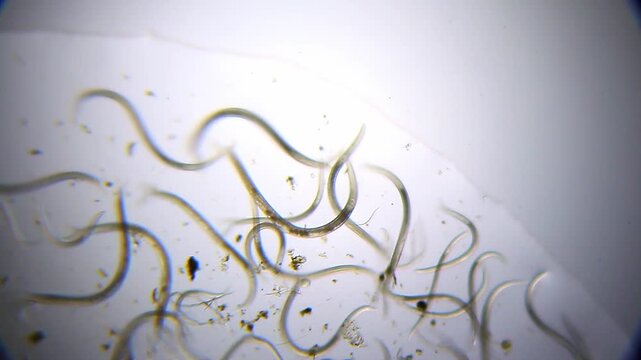 Multiple nematodes moving in wave-like motion under 40x magnification brightfield microscopy. 4K scientific microscopy footage.