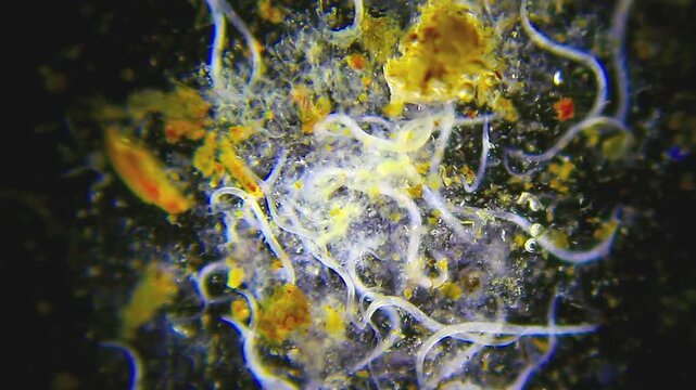 Multiple nematodes moving densely among detritus under 40x magnification darkfield microscopy. 4K scientific microscopy footage.