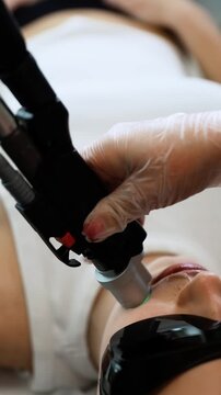 Laser hair removal on woman face during treatment session showing contact epilation method and professional skincare procedure in clinic
