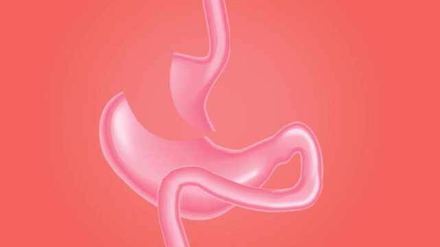 Gastric bypass surgery medical procedure on human stomach and digestive system.