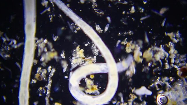 Annelids moving with rotifer colony in background under 40x magnification darkfield microscopy. 4K scientific microscopy footage.