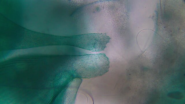 Stentor attached to substrate with surrounding bacteria under 400x magnification brightfield microscopy. 4K scientific microscopy footage.