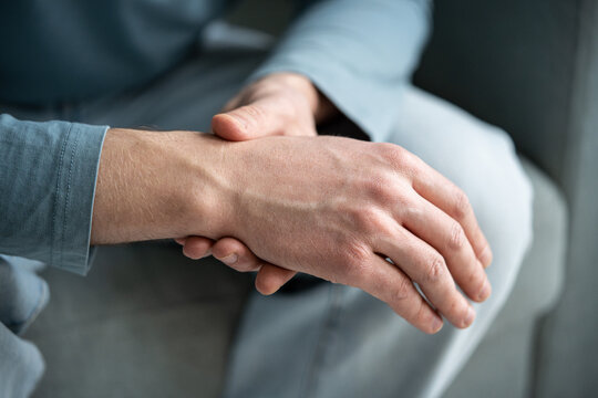 Healthcare and skincare, male hands with dry sensitive skin, affected areas with dryness and flaky peeling spots between fingers. Man having itchy skin problems, body problems because of dehydration.