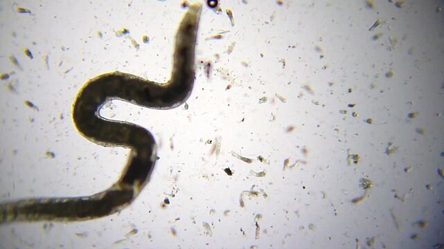 Annelid moving with rotifer colony in background under 40x magnification brightfield microscopy. 4K scientific microscopy footage.