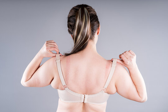 Rear view of plus size woman pulling tight bra straps showing red marks on skin, ill-fitting lingerie