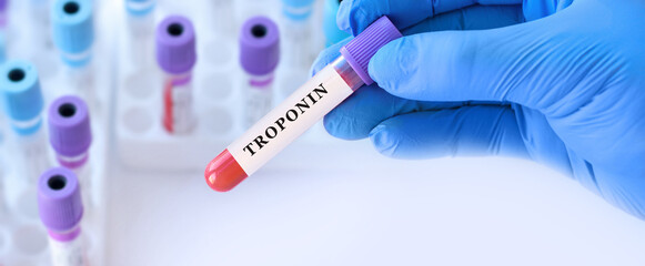 Naklejka premium Doctor holding blood sample tube with troponin test in medical laboratory, cardiac diagnostics and acute heart condition concept
