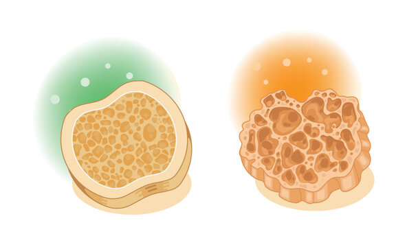 Dense Bone Tissue and Porous Bone Tissue Anatomy Illustration