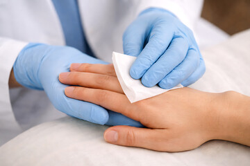Fototapeta premium Medical Cleaning of Hand With Antiseptic Wipe Close Up for Hygiene Infection Control and Clinical Care Procedures