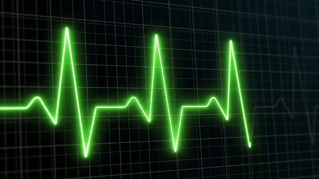 Ecg monitor graphic showing a green heart rate line on a dark grid background