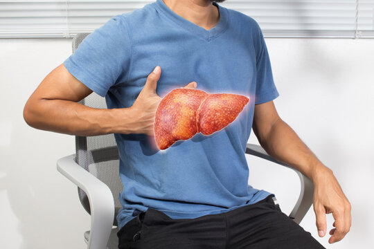 Male holding abdomen with highlighted liver illustrating cirrhosis hepatitis inflammation and related complications in healthcare concept