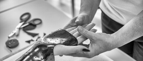Hand splint application by a professional therapist in a modern physiotherapy center