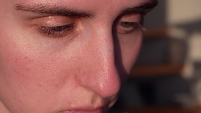 Close up of young woman touching her nose with visible blackheads and pores. Skincare concept, clogged pores, natural skin texture and dermatology issues without retouching.