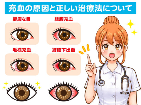 ドライアイの説明をする看護師の女性のアニメ系イラスト素材2