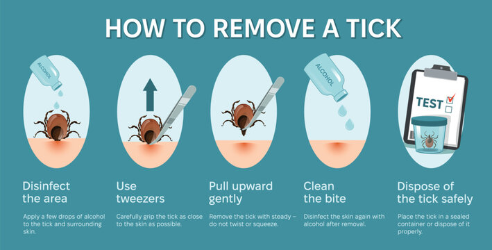 How to remove tick steps Infographic banner. Instruction to prevent Lyme or borreliosis disease because of mite bite. Laboratory testing.