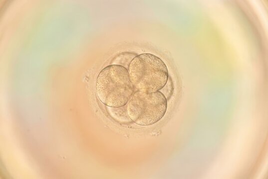 Four cell human embryo developing after in vitro fertilization, visible under a microscope, representing early stages of life, conception, and assisted reproductive technologies