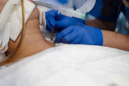 Doctor adjusting patient's tracheotomy tube during medical procedure