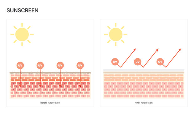UV Protection Sunscreen Before and After Comparison on Skin Structure with Sun Rays