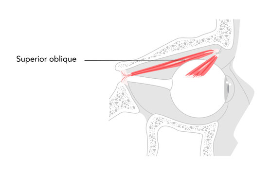 Superior oblique - Human eye muscle labeled diagram illustrating intorsion, depression, and outward movement of the eye, important for anatomical learning.