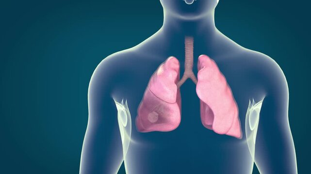Pneumonia illness, healthy lungs and disease lungs, Human Lungs cancer, Cigarette smokers Lung disease, cancerous malignant tumor growing and spreading, respiratory system, asthma infection. 3D.