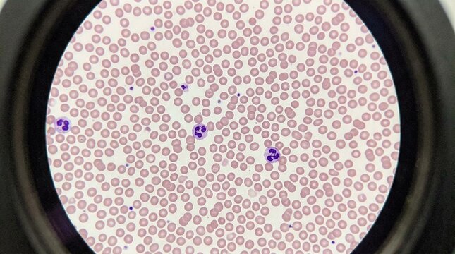 Blood Smear Slide Under Microscope Lens Showing Red Blood Cell Layer No Face No Logo No Text