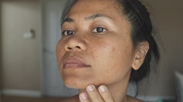 Close-up of a woman examining acne and skin condition, turning her head to check both cheeks and gently touching her chin. Natural light, real skin texture, skincare and dermatology concept.