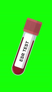 ESR Blood Test Tube Animation on Green Screen Background, Erythrocyte Sedimentation Rate Test, Medical Lab Sample, Healthcare Laboratory Concept