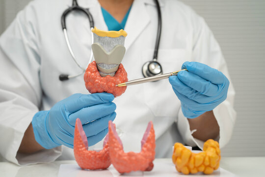 Hyperthyroidism, Overactive Thyroid, Thyroid Lymphoma, Asian doctor with thyroid gland human anatomy model in hospital.