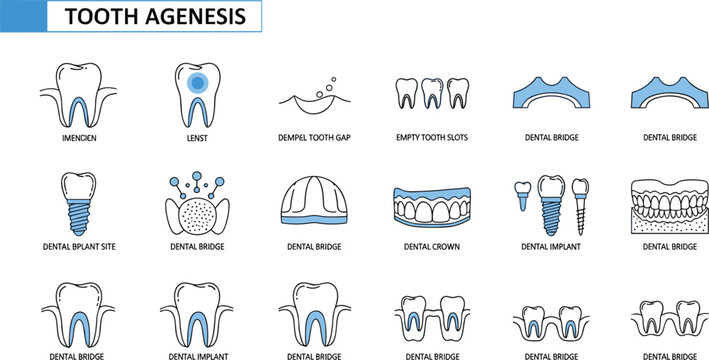 Medical collection of tooth agenesis icons featuring dental implants bridges crowns and missing teeth for stomatology education,
