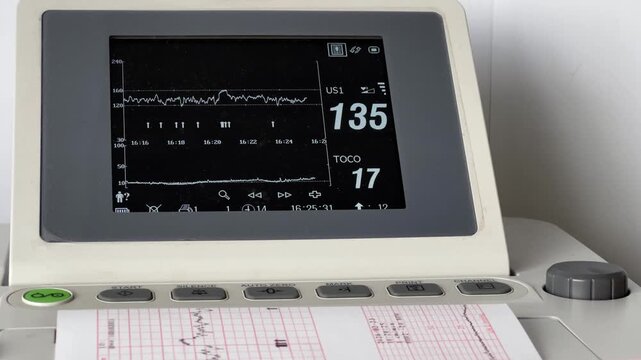 Medical cardiotocography machine in a hospital clinic performing a fetal non-stress test, monitoring the baby's heartbeat and uterine contractions while printing the cardiogram results