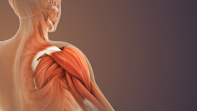 Injured Shoulder Muscle with Pain and Inflammation