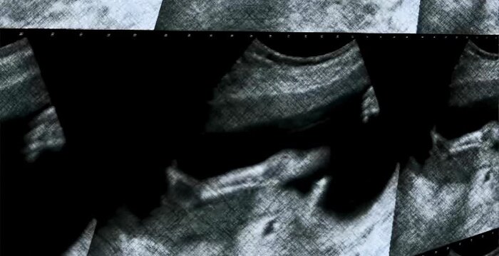 Close-up view of multiscreen ultrasound echographs in a hospital, showing real-time diagnostic images and advanced medical technology