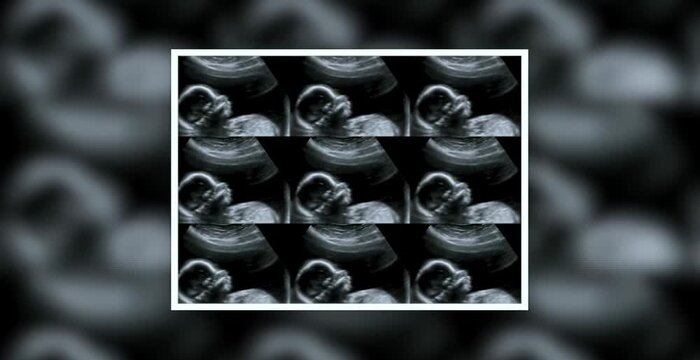 Close-up view of multiscreen ultrasound echographs in a hospital, showing real-time diagnostic images and advanced medical technology