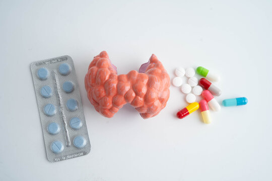 Thyroid model with pill drug treatment, Hyperthyroidism, Overactive or Lymphoma.
