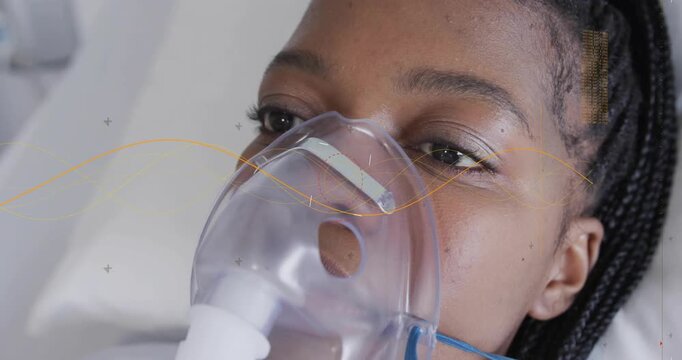 Woman breathing via O2 mask, blinking, opening eyes, waking with wavy health lines crossing face